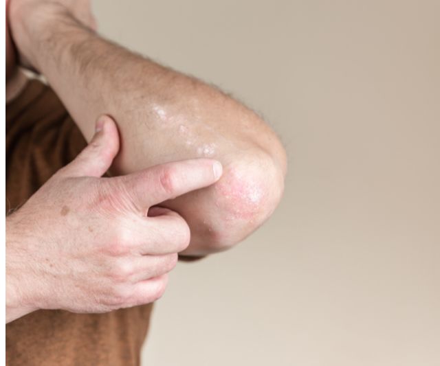 tratamiento para codos y rodillas oscuras, piel uniforme y luminosa.