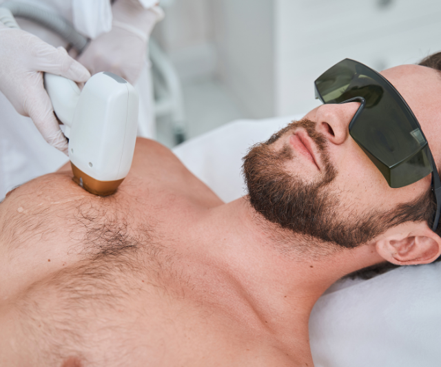 depilacion laser cera pecho