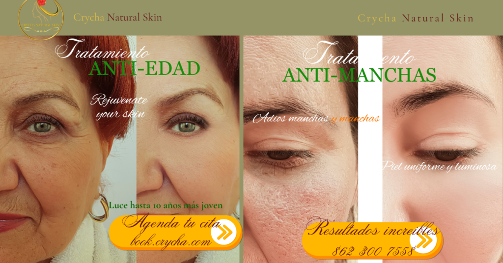 rejuvenecimiento facial